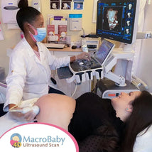 Macrobaby 4D Ultrasound Packages | Orlando, FL.