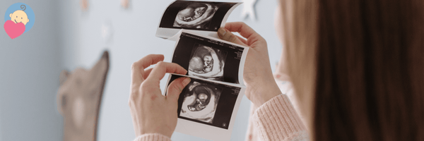 Weeks or months: how to count pregnancy? - MacroBaby