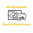 4D Ultrasound Add-On - Black and White Picture.