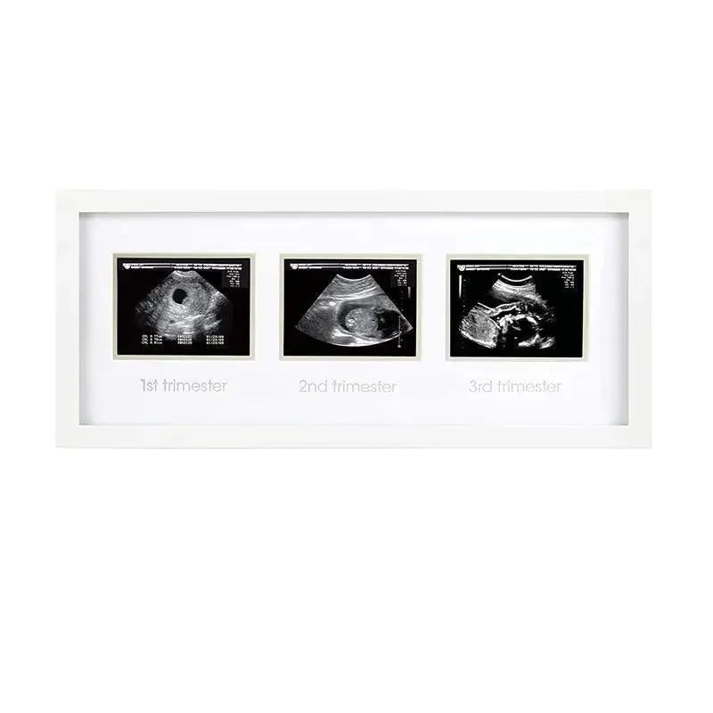 Pearhead - Trimester Sonogram Frame, White Image 1