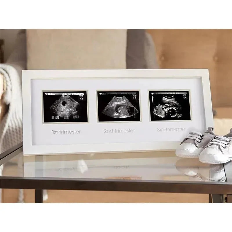 Pearhead - Trimester Sonogram Frame, White Image 2